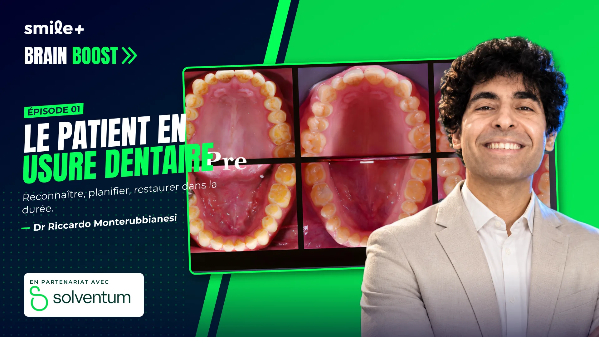 Le patient en usure dentaire (Brain Boost) : Conférence du Dr Riccardo Monterubbianesi : le patient en usure dentaire, du diagnostic à la…