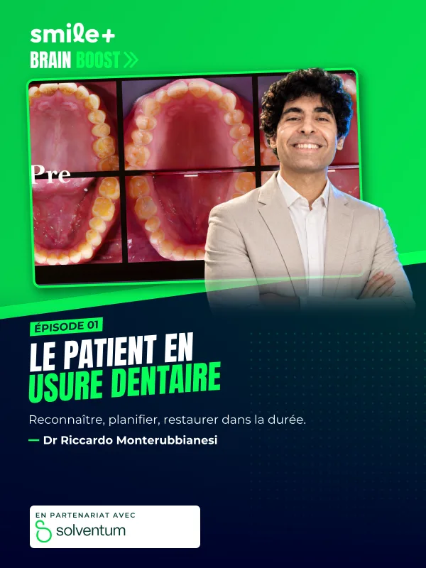 Le patient en usure dentaire (Brain Boost) : Conférence du Dr Riccardo Monterubbianesi : le patient en usure dentaire, du diagnostic à la…