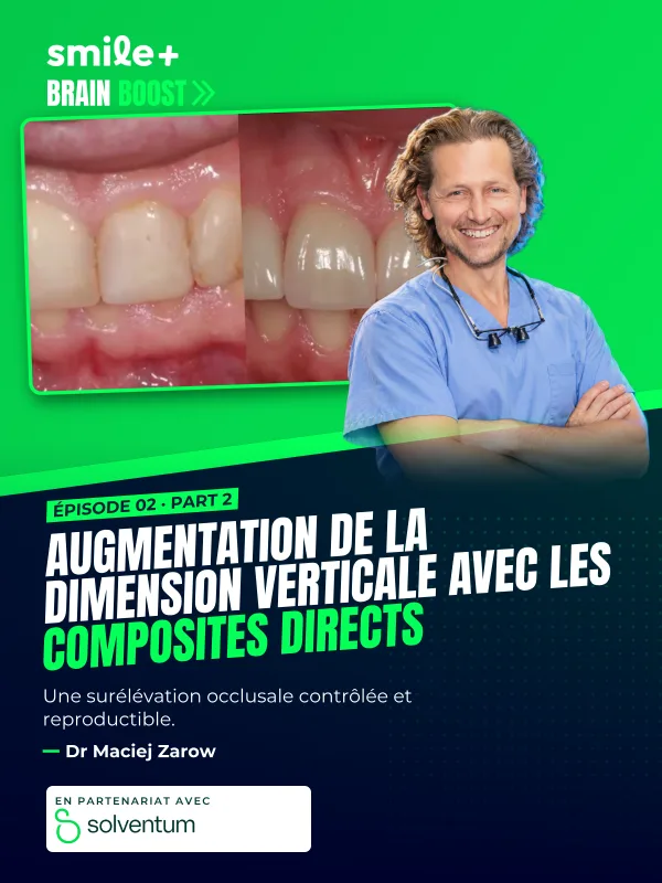 Augmentation de la dimension verticale avec les composites directs - part1 (Brain Boost)