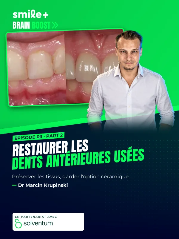 Restaurer les dents antérieures usées - part1 (Brain Boost) : Conférence et atelier du Dr Marcin Krupinski : restaurer les dents antérieures usées…