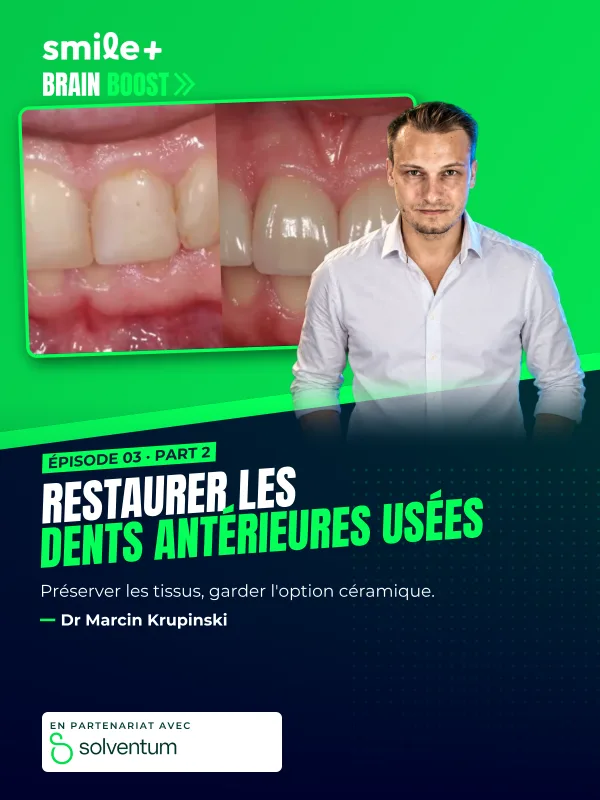 Restaurer les dents antérieures usées - part2 (Brain Boost) : Conférence du Dr Maciej Zarow : augmenter la dimension verticale d'occlusion aux…