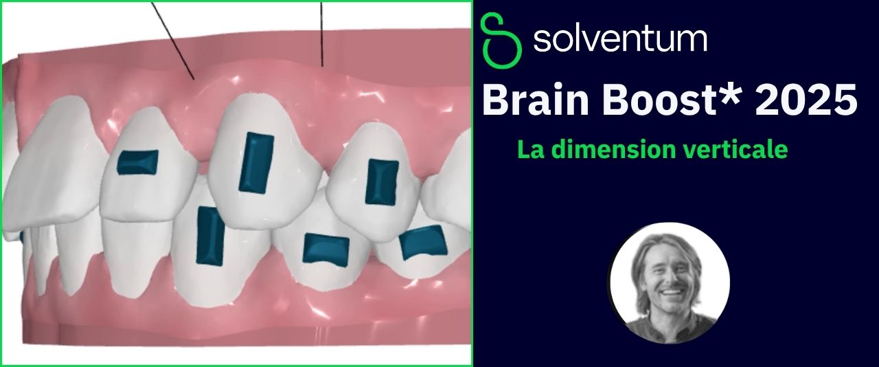 La dimension verticale (Brain Boost) : Conférence du Dr Filippo Cipriani Noce : la dimension verticale abordée sous l'angle orthodontique, un point…