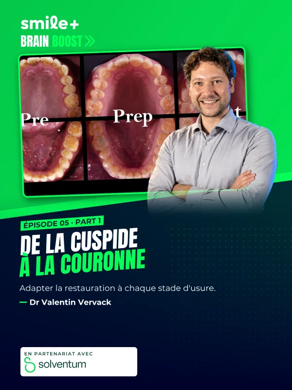 De la cuspide à la couronne - part1 (Brain Boost) : Conférence du Dr Valentin Vervack : prendre en charge l'usure dentaire, du stade très précoce…