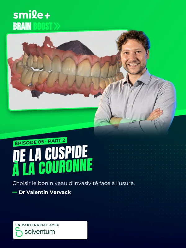 De la cuspide à la couronne - part2 (Brain Boost) : Atelier pratique du Dr Valentin Vervack : reconstruire les cuspides sur molaire usée et préparer…
