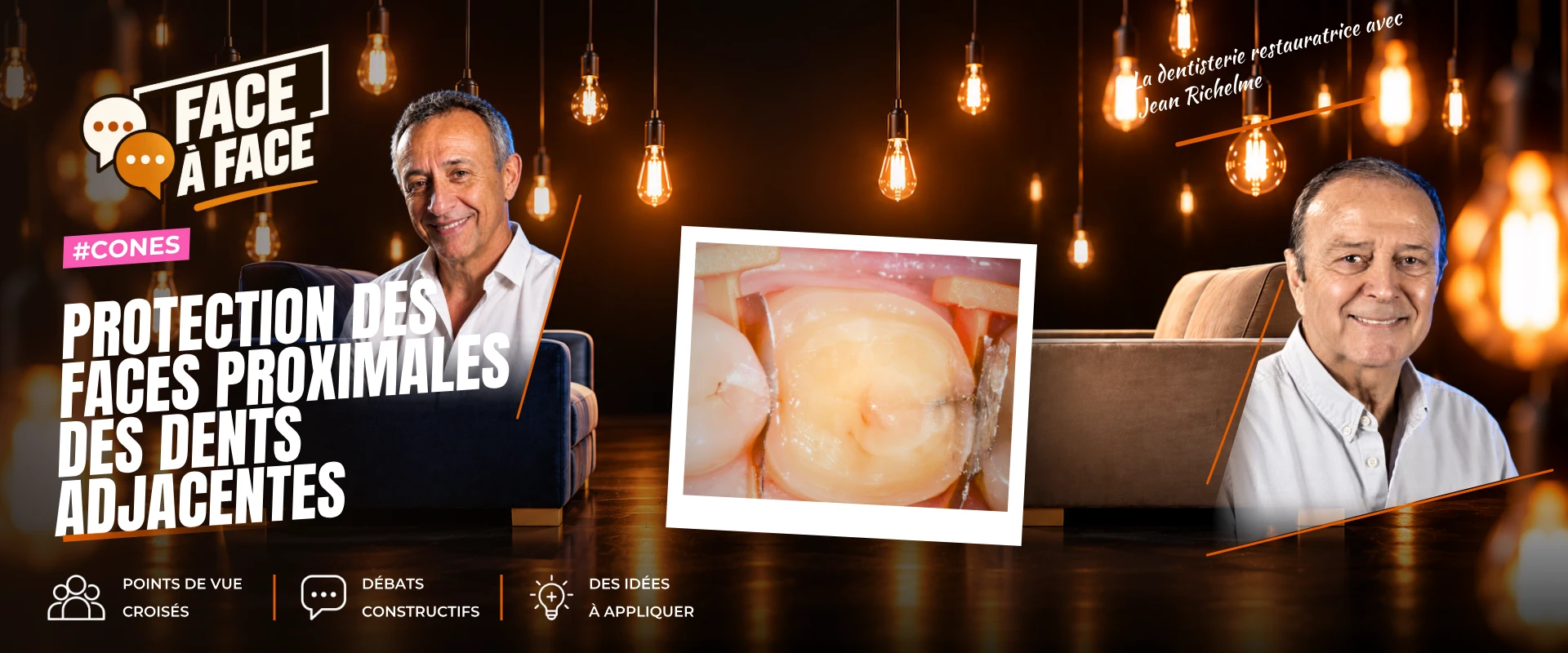 Protection des faces proximales des dents adjacentes (Face à Face, saison 1 épisode 1) : Conserver l'anatomie des faces proximales des dents saines…