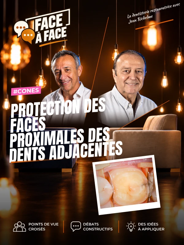 Protection des faces proximales des dents adjacentes (Face à Face, saison 1 épisode 1) : Conserver l'anatomie des faces proximales des dents saines…