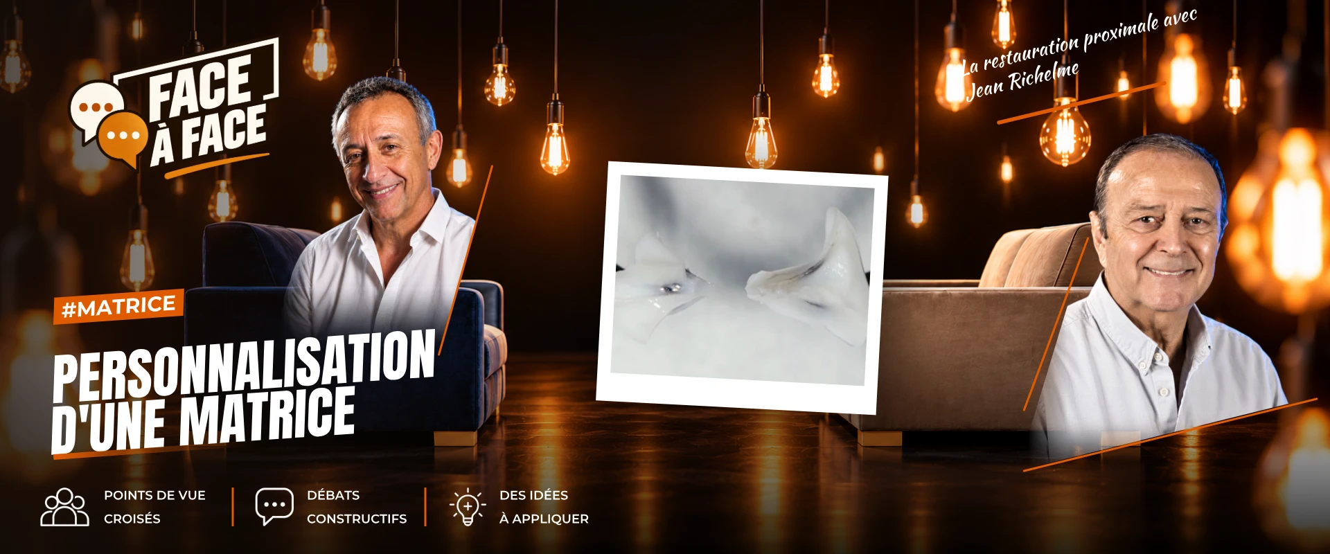 Personnalisation d'une matrice (Face à Face, saison 1 épisode 2) : Reproduire l'anatomie des faces proximales à l'aide d'une matrice personnalisée