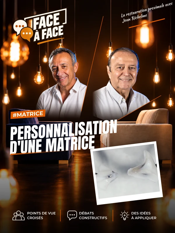Personnalisation d'une matrice (Face à Face, saison 1 épisode 2) : Reproduire l'anatomie des faces proximales à l'aide d'une matrice personnalisée