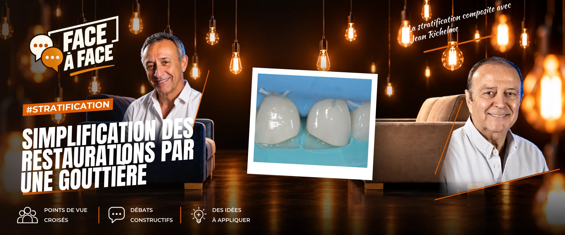 Simplification des restaurations par une gouttière (Face à Face, saison 1 épisode 6) : Restauration composite à l'aide d'une clé en silicone