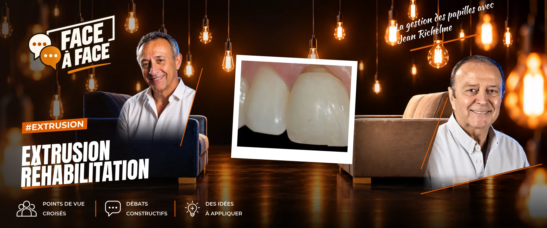 Extrusion réhabilitation (Face à Face, saison 1 épisode 8) : Réhabilitation papillaire grâce à une technique d'extrusion orthodontique