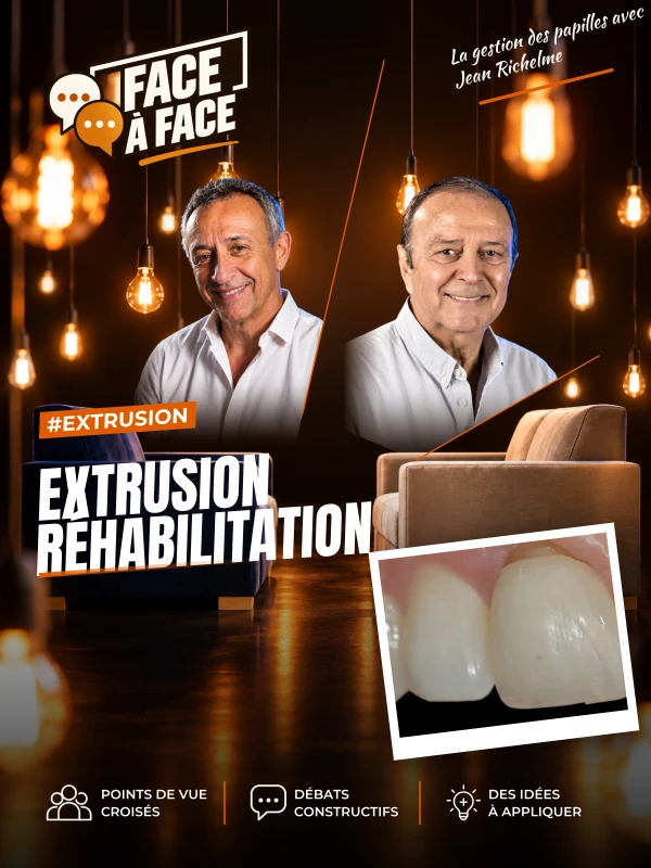 Extrusion réhabilitation (Face à Face, saison 1 épisode 8) : Réhabilitation papillaire grâce à une technique d'extrusion orthodontique