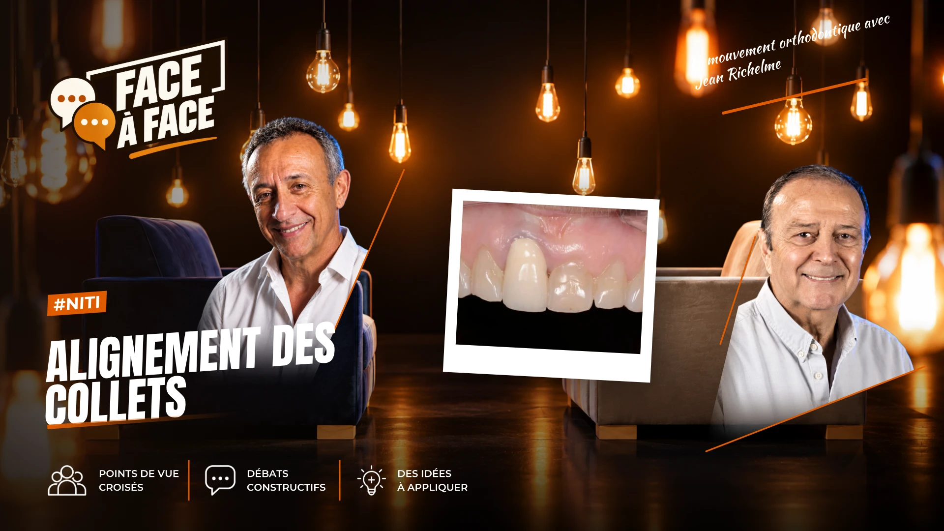 Alignement des collets (Face à Face, saison 1 épisode 10) : Alignement des collets en omnipratique