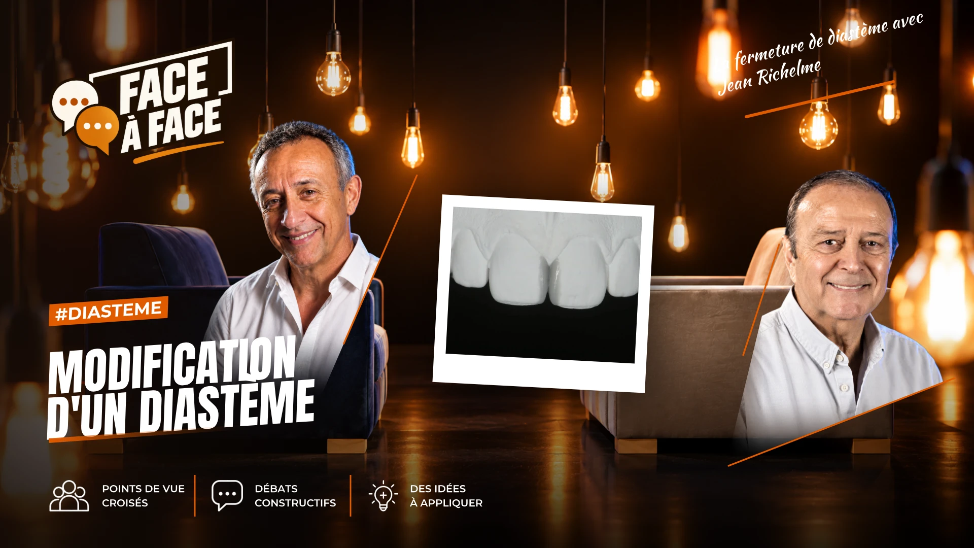 Modification d'un diastème (Face à Face, saison 1 épisode 12) : Recréer une symétrie avec la fermeture d'un diastème