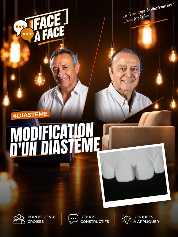 Modification d'un diastème (Face à Face, saison 1 épisode 12) : Recréer une symétrie avec la fermeture d'un diastème