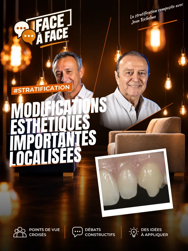 Modifications esthétiques importantes localisées (Face à Face, saison 1 épisode 13) : Modification morphologique localisée en stratification…
