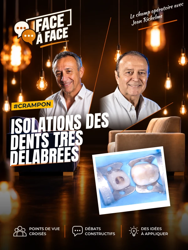 Isolations des dents très délabrées (Face à Face, saison 1 épisode 14) : Pose et stabilisation du champ opératoire sur dents très délabrées