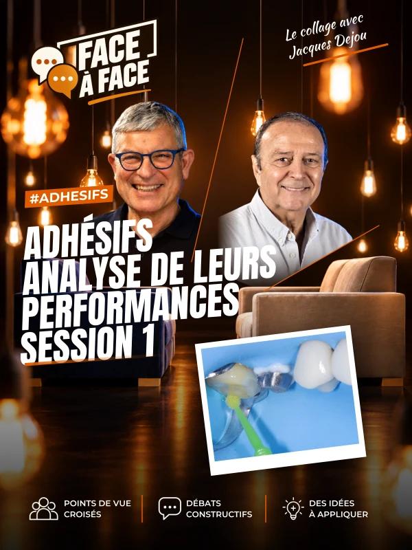 Adhésifs analyse de leurs performances session 1 (Face à Face, saison 1 épisode 16) : Analyse des performances des différents systèmes adhésifs .