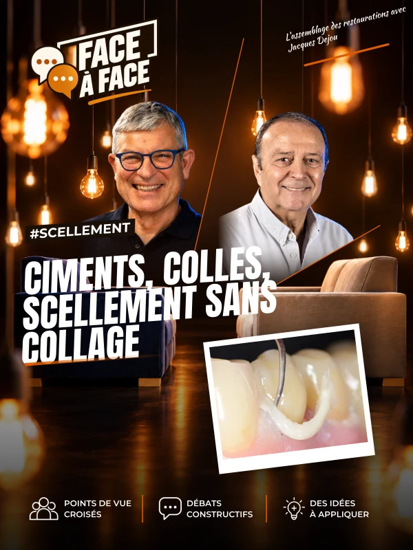 Ciments, colles, scellement sans collage (Face à Face, saison 1 épisode 17) : Ciments et colles : differences, indications