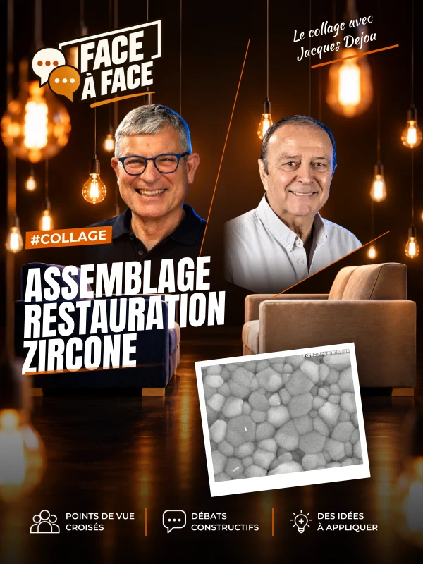 Assemblage restauration zircone (Face à Face, saison 1 épisode 19) : Collage à la zircone : mise en oeuvre et matériaux