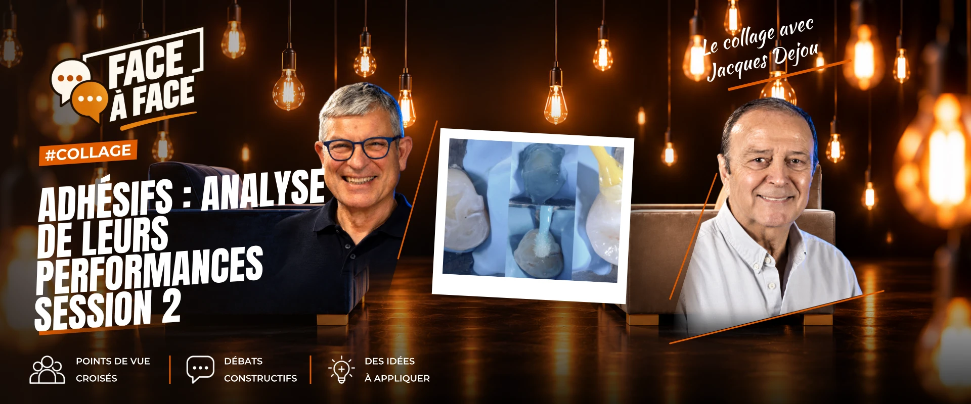Adhésifs : analyse de leurs performances session 2 (Face à Face, saison 1 épisode 21) : Analyse des performances des différents systèmes adhésifs .