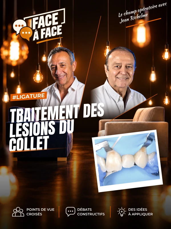 Traitement des lésions du collet (Face à Face, saison 1 épisode 22) : Accès à la limite des collets sous digue grâce à la pose de ligatures