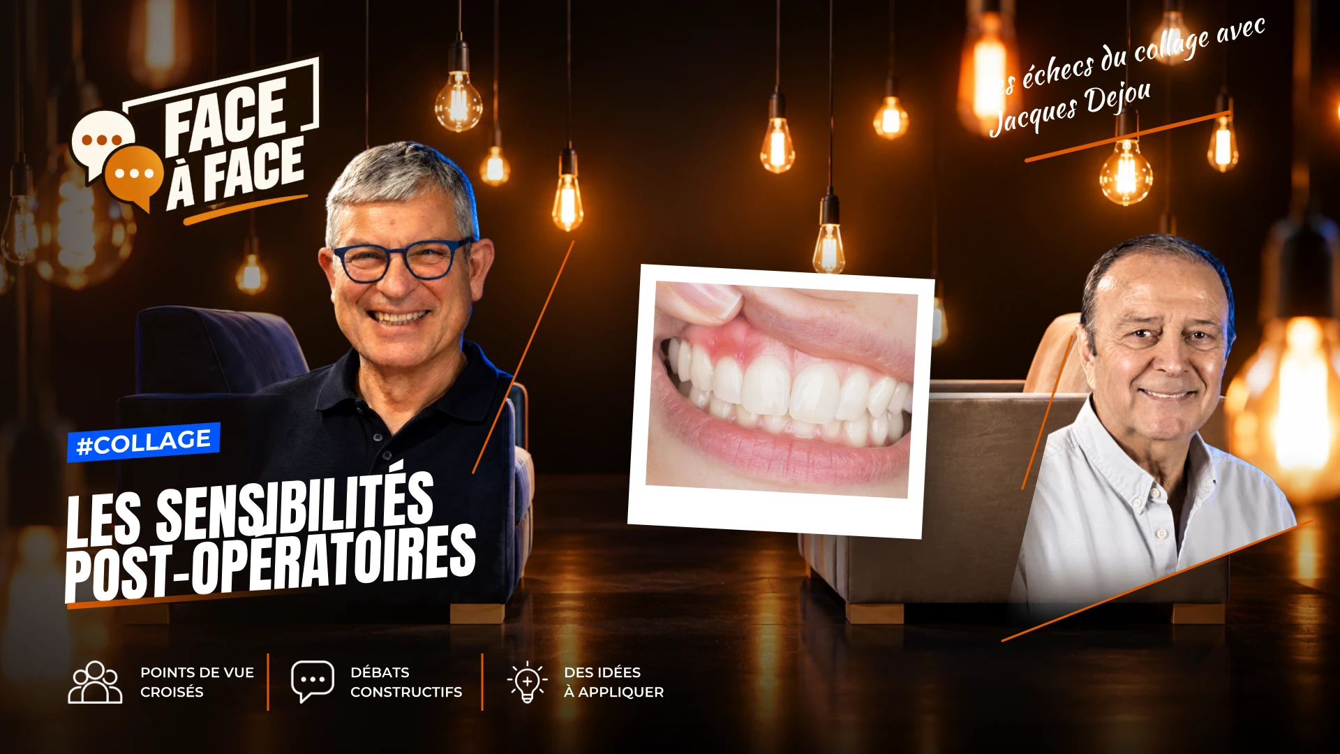 Les sensibilités post-opératoires (Face à Face, saison 1 épisode 27) : Dans cette vidéo, Les DrJacques DEJOU et André FAUCHER abordent les causes…