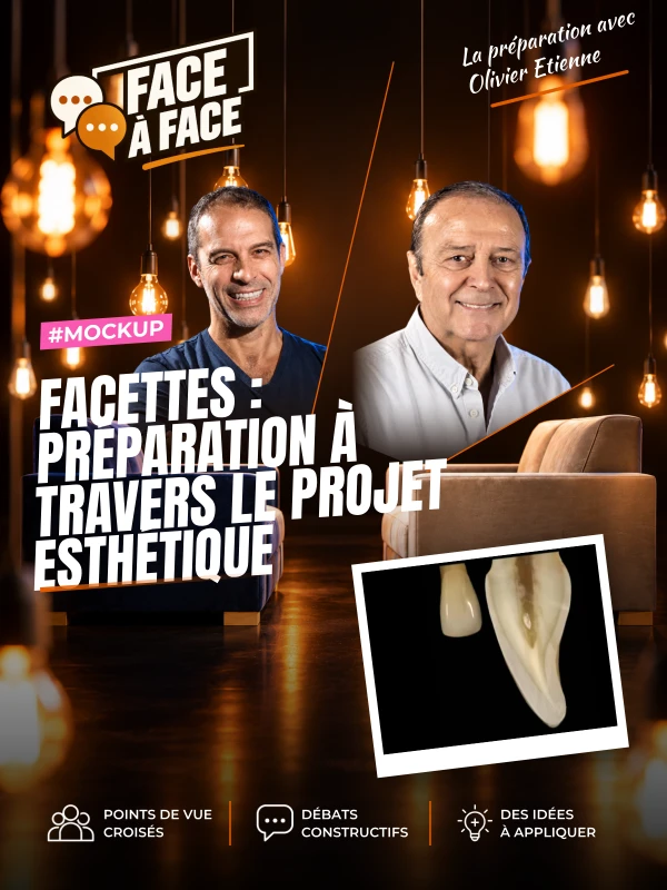 Facettes : préparation à travers le projet esthétique (Face à Face, saison 1 épisode 29) : Facettes : préparation à travers les masques ou le…
