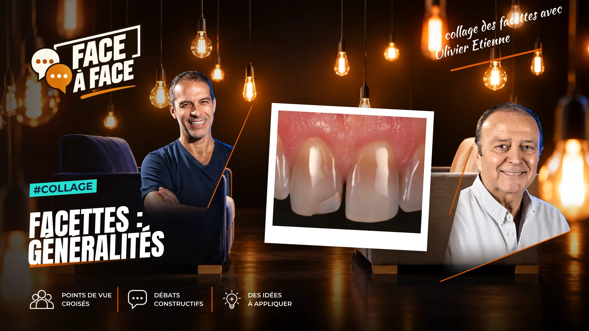 Facettes : généralités (Face à Face, saison 1 épisode 30) : Facettes : stratégie de collage, choix de l'isolation, de l'adhésif , de la pâte de…