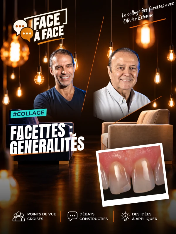 Facettes : généralités (Face à Face, saison 1 épisode 30) : Facettes : stratégie de collage, choix de l'isolation, de l'adhésif , de la pâte de…