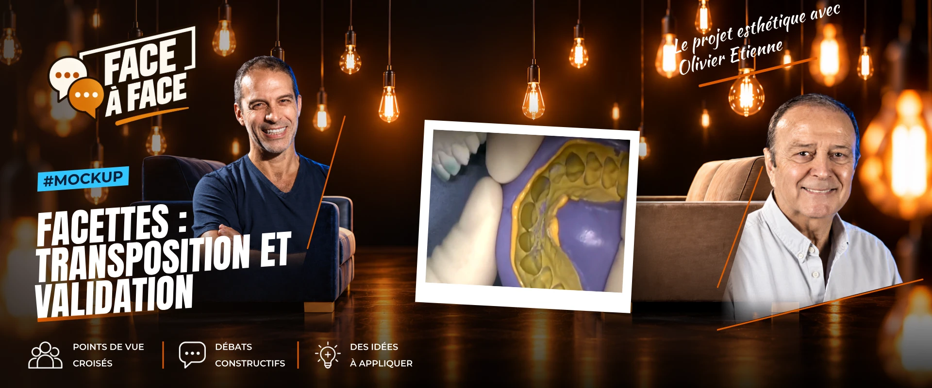 Facettes : transposition et validation (Face à Face, saison 1 épisode 31) : Facettes : la validation et la transposition du projet esthétique est…