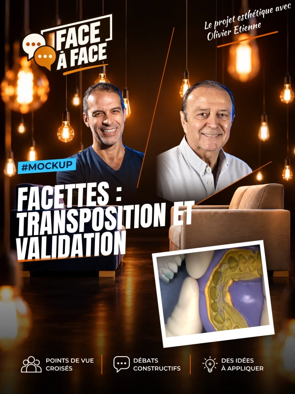 Facettes : transposition et validation (Face à Face, saison 1 épisode 31) : Facettes : la validation et la transposition du projet esthétique est…