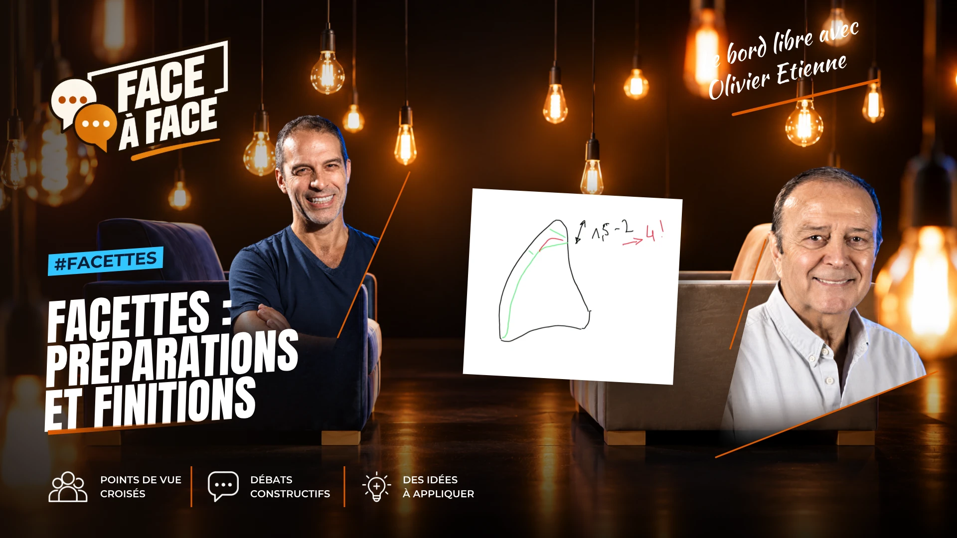 Facettes : préparations et finitions (Face à Face, saison 1 épisode 32) : Facettes : pourquoi les facettes sont-elles si économes de tissu ?