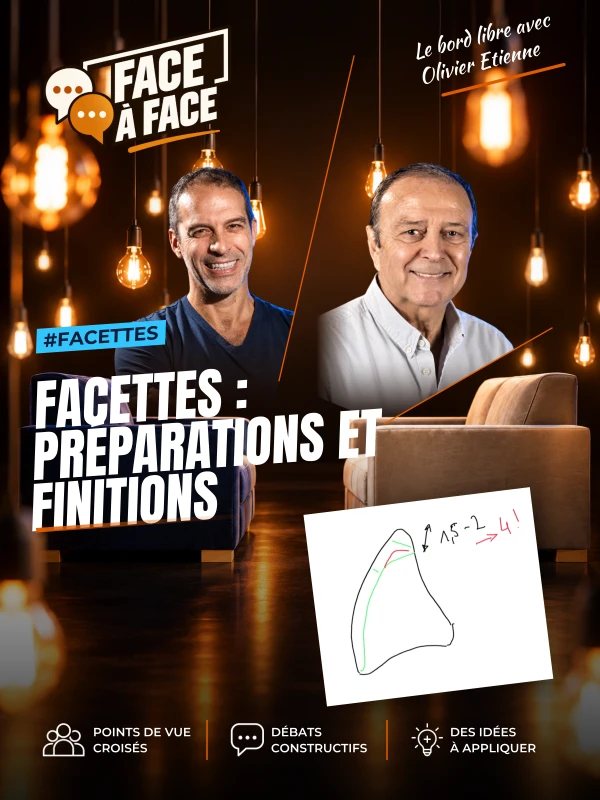 Facettes : préparations et finitions (Face à Face, saison 1 épisode 32) : Facettes : pourquoi les facettes sont-elles si économes de tissu ?
