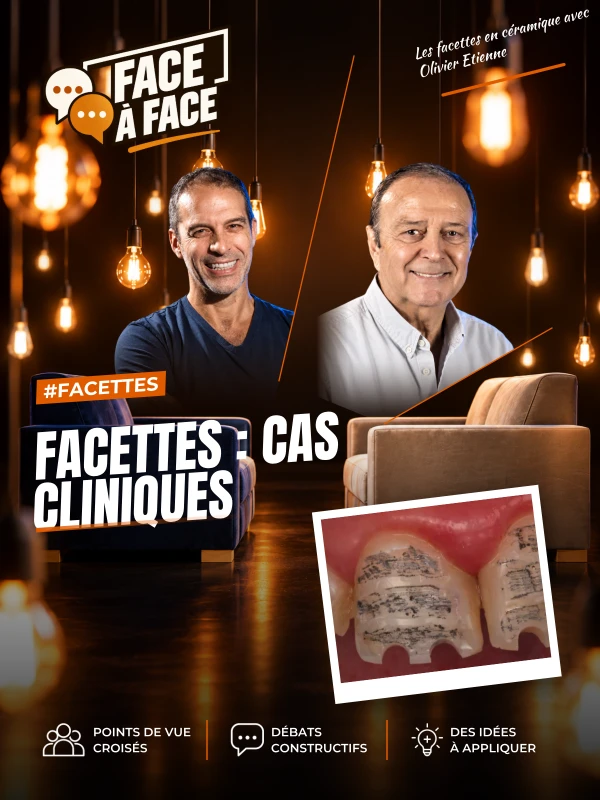 Facettes : cas cliniques (Face à Face, saison 1 épisode 34) : Facettes : cas cliniques particuliers