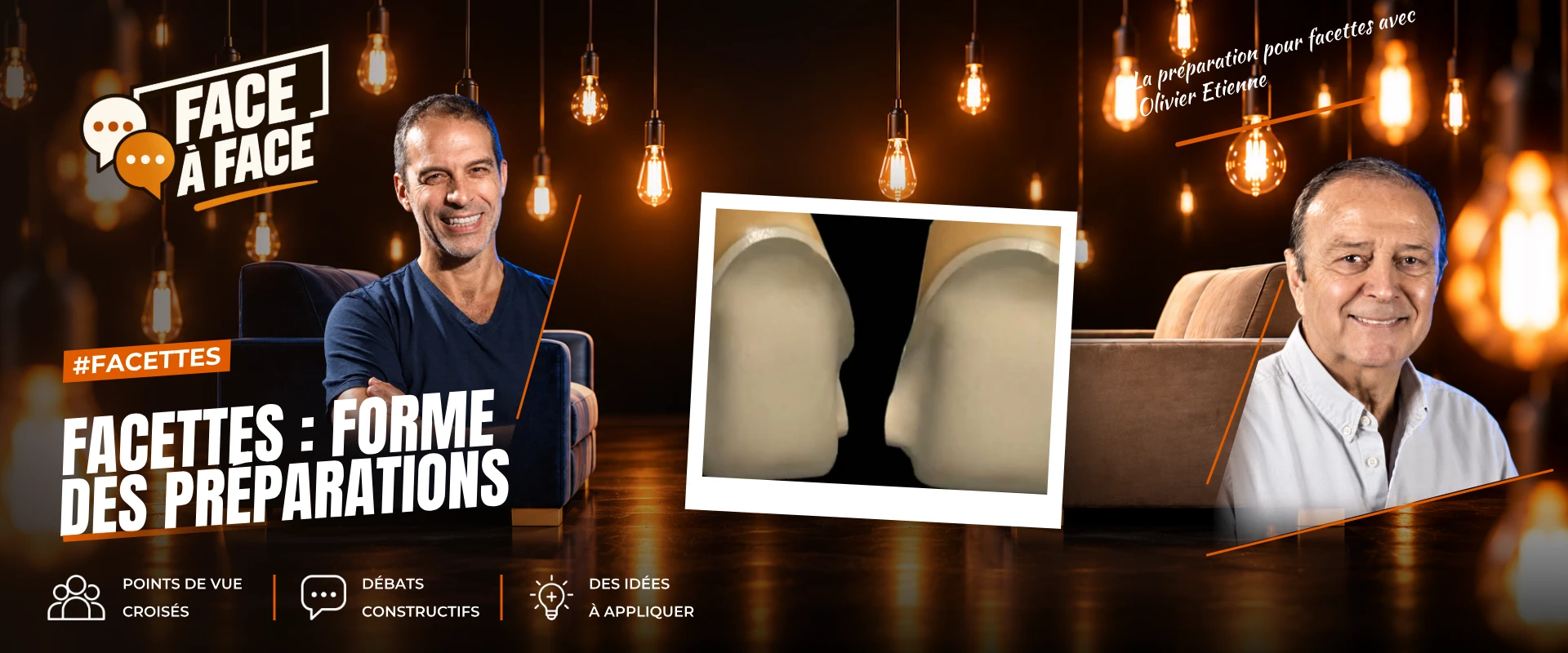 Facettes : forme des préparations (Face à Face, saison 1 épisode 35) : Facettes : formes des préparations : comment prendre une décision de…