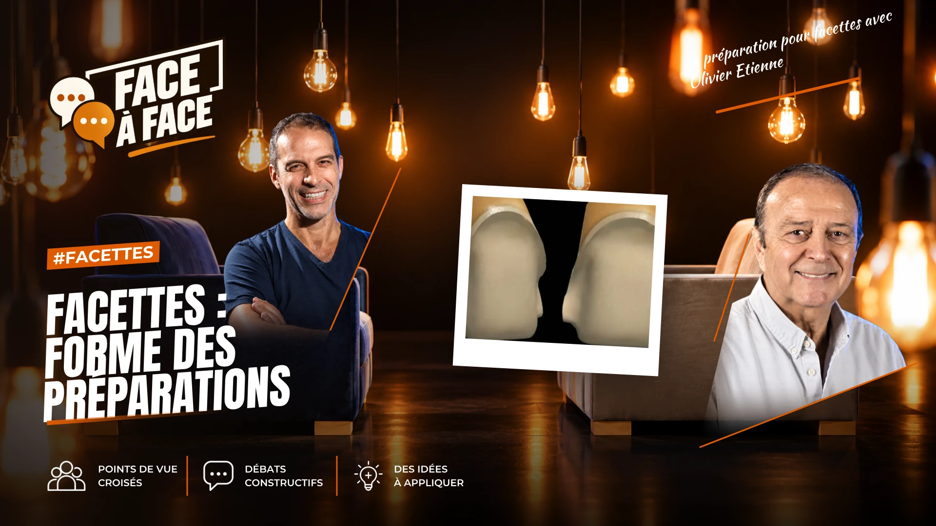 Facettes : forme des préparations (Face à Face, saison 1 épisode 35) : Facettes : formes des préparations : comment prendre une décision de…