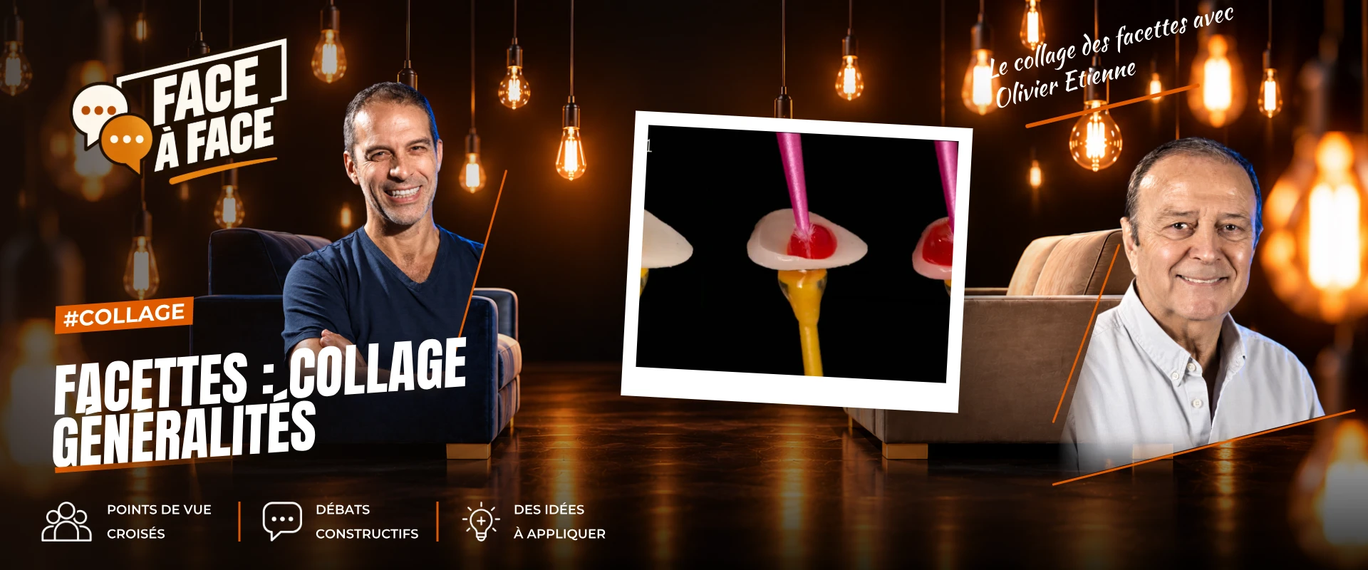 Facettes : collage généralités (Face à Face, saison 1 épisode 38) : Facettes : collage généralités : protocoles détaillés de la préparation de la…