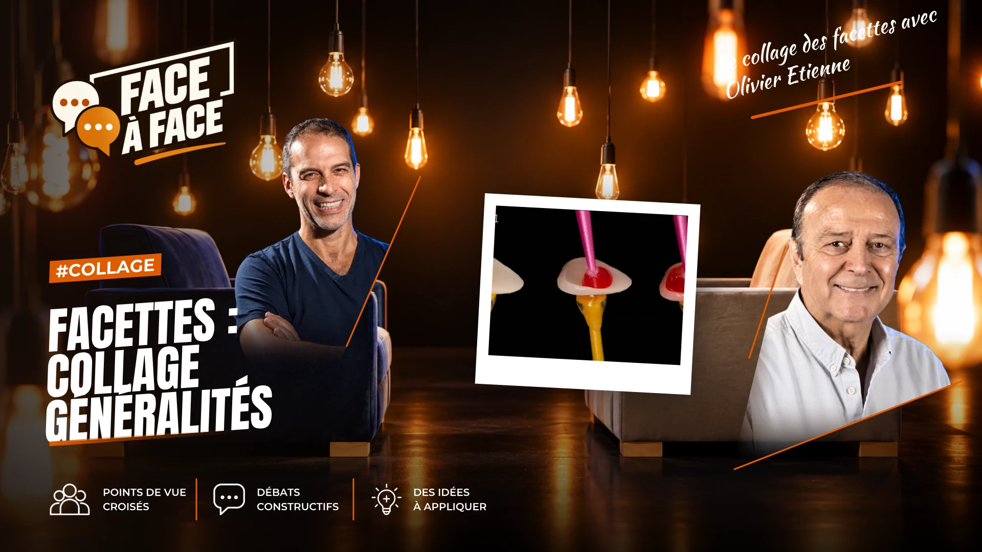 Facettes : collage généralités (Face à Face, saison 1 épisode 38) : Facettes : collage généralités : protocoles détaillés de la préparation de la…