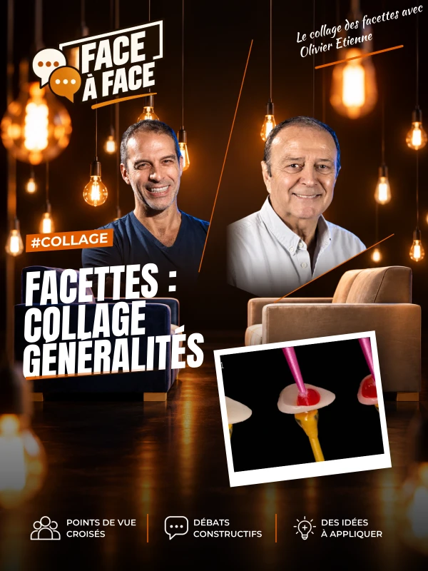 Facettes : collage généralités (Face à Face, saison 1 épisode 38) : Facettes : collage généralités : protocoles détaillés de la préparation de la…