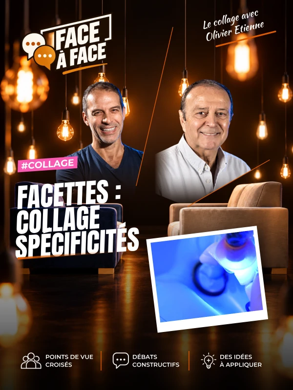 Facettes : collage spécificités (Face à Face, saison 1 épisode 39) : Dans cet épisode, les Dr Olivier ETIENNE et André FAUCHER abordent les…