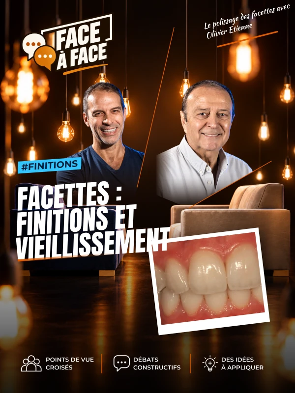 Facettes : finitions et vieillissement (Face à Face, saison 1 épisode 40) : Facettes : finitions et vieillissement .