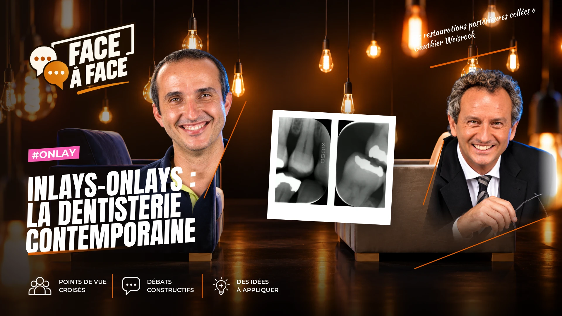Inlays-onlays : la dentisterie contemporaine (Face à Face, saison 1 épisode 41) : Inlays Onlays : état des lieux de la dentisterie conservatrice…
