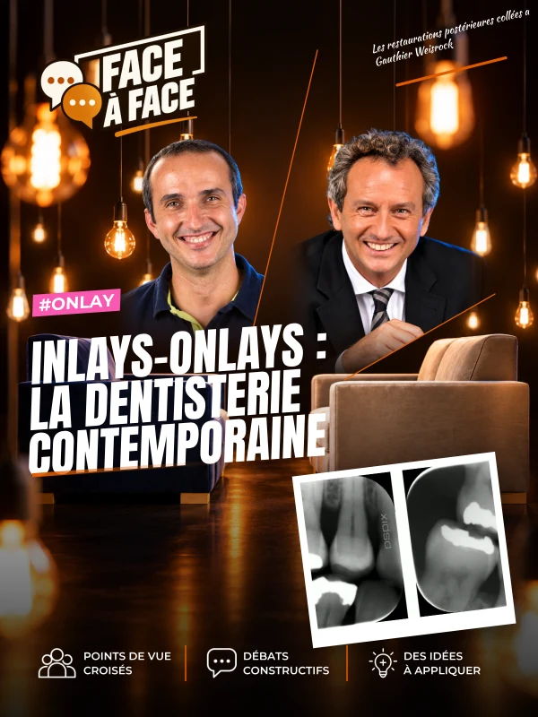 Inlays-onlays : la dentisterie contemporaine (Face à Face, saison 1 épisode 41) : Inlays Onlays : état des lieux de la dentisterie conservatrice…