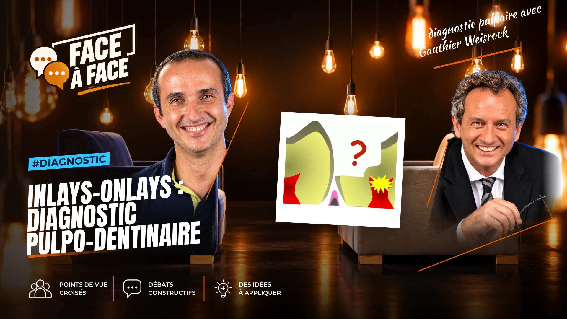 Inlays-onlays : diagnostic pulpo-dentinaire (Face à Face, saison 1 épisode 42) : IInlays-Onlays : le diagnostic pulpo-dentianaire au centre de nos…
