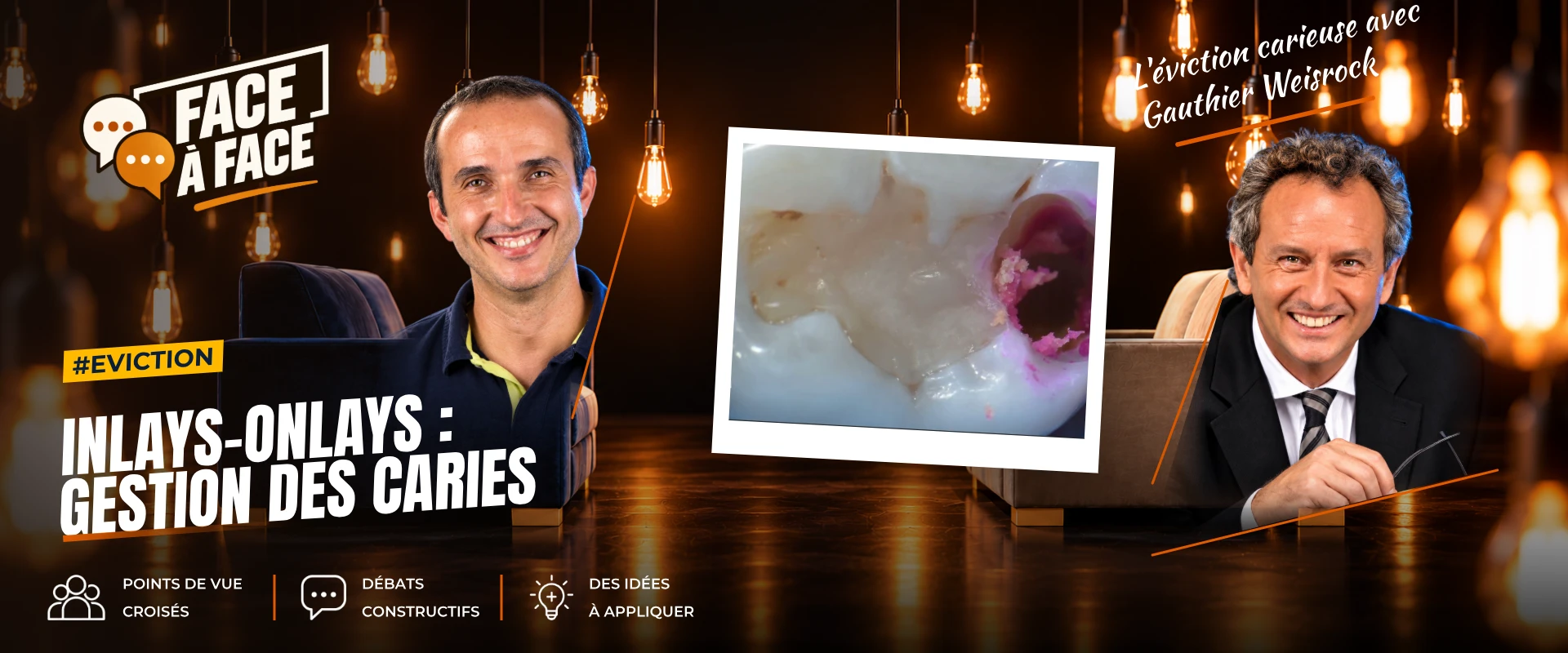 Inlays-onlays : gestion des caries (Face à Face, saison 1 épisode 43) : Inlays-Onlays : gestion des caries : de la compréhension de l'histologie aux…