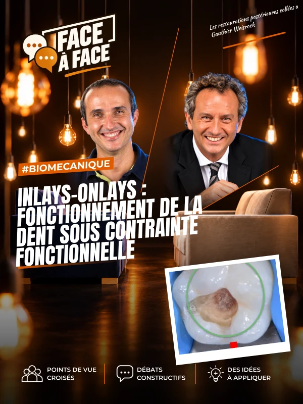 Inlays-onlays : fonctionnement de la dent sous contrainte fonctionnelle (Face à Face, saison 1 épisode 44)