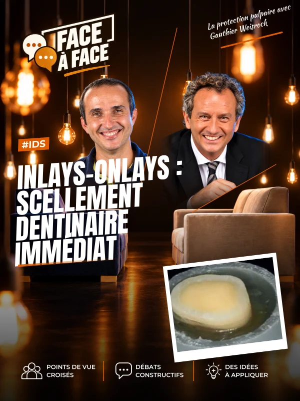 Inlays-onlays : scellement dentinaire immédiat (Face à Face, saison 1 épisode 46)