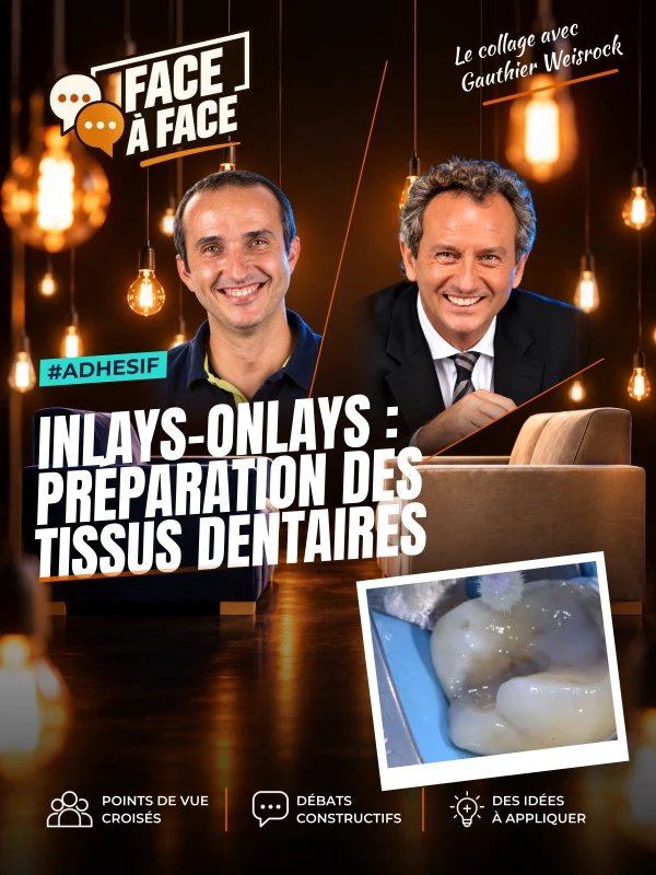 Inlays-onlays : préparation des tissus dentaires (Face à Face, saison 1 épisode 49) : Inlays-Onlays : préparation des tissus dentaires : choix de…