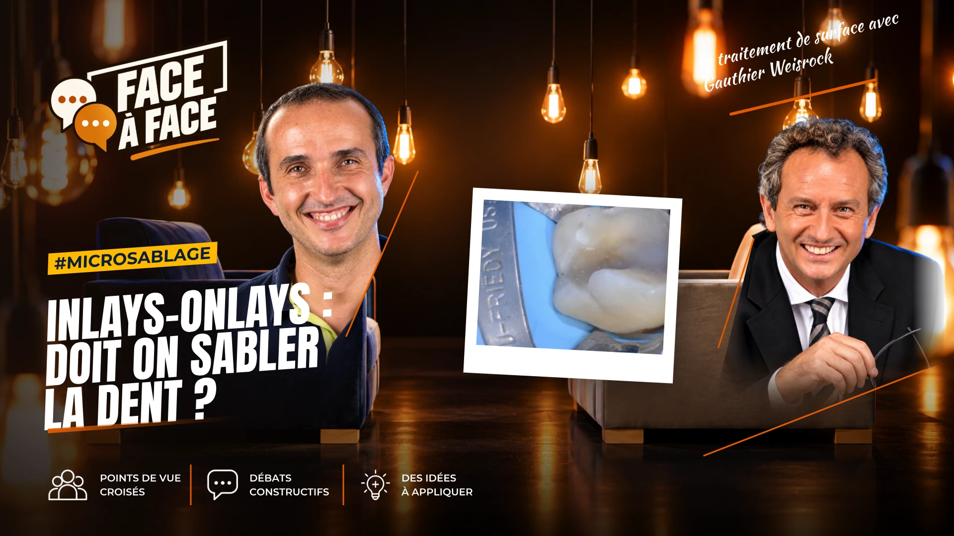 Inlays-onlays : doit on sabler la dent ? (Face à Face, saison 1 épisode 50)