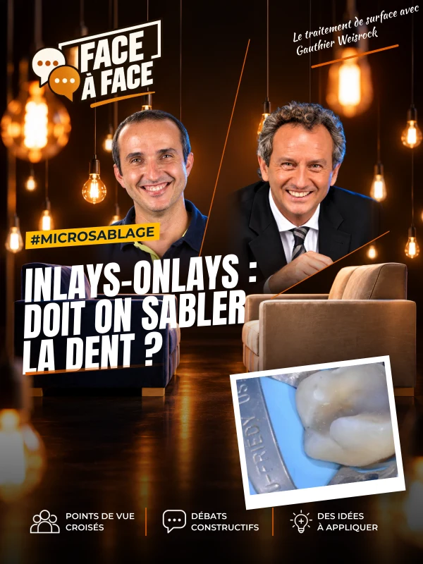 Inlays-onlays : doit on sabler la dent ? (Face à Face, saison 1 épisode 50)